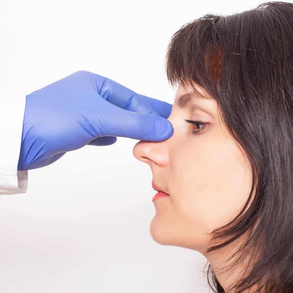 Rhinoplasty